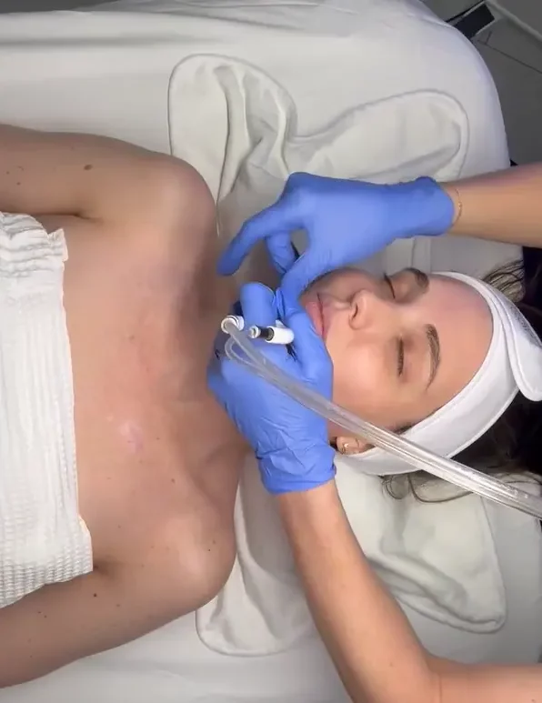 Diamond Glow Facial by Bradenton Aesthetics in Bradenton, FL
