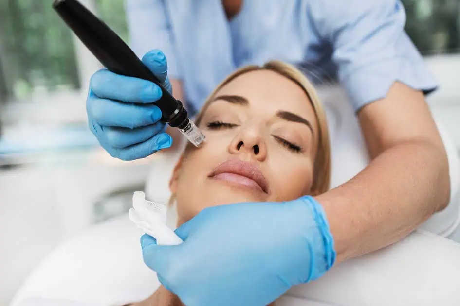 SkinPen Microneedling Treatments in Bradenton, FL by Bradenton Aesthetics